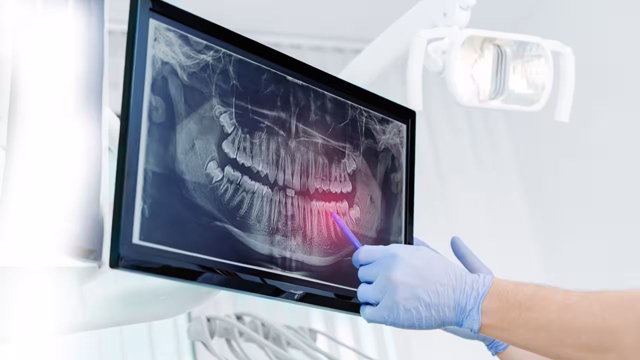 Digital X-rays at Yasko Dental Hospital